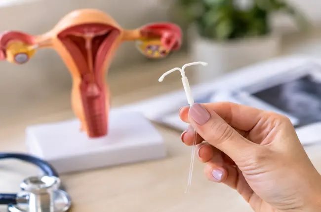 Maternidade Alto Maracanã em Colombo: Implante de DIU hormonal